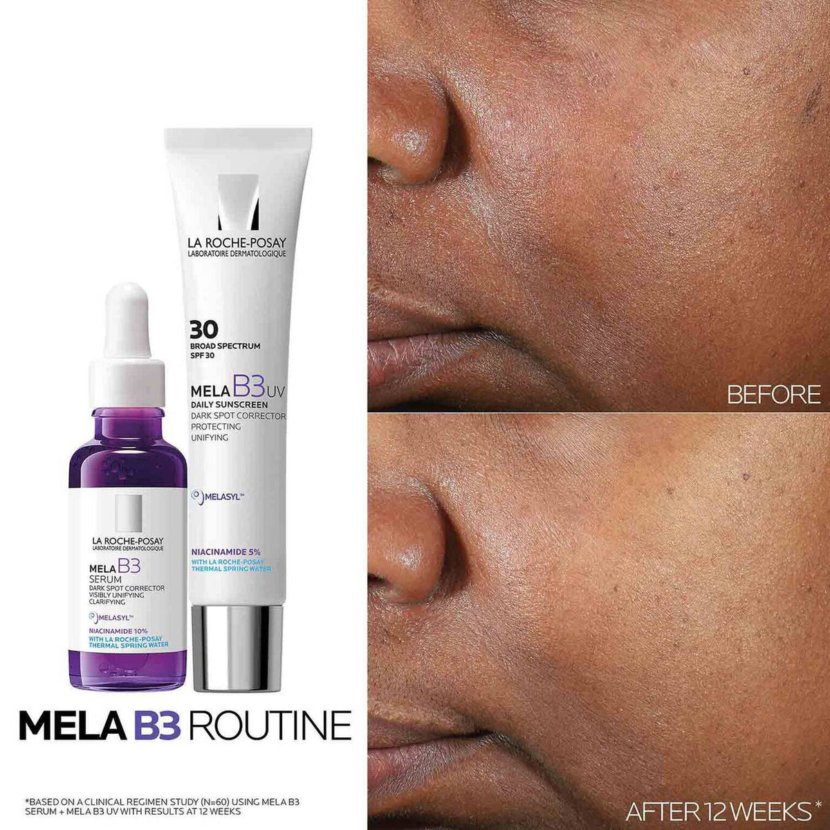 mela-b3-dark-spot-serum-and-mela-b3-uv-daily-moisturizer-with-spf-30-y7 3-Mela-B3-routine_1500X1500.jpg 3-Mela-B3-routine_1500X1500_699afb5eaaaf.jpg