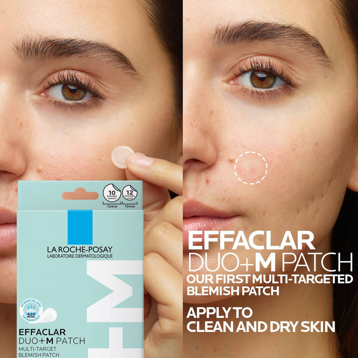 effaclar-duo-m-multi-target-blemish-patches-j1 Effaclar-Patch-Models-1500x1500.jpg Effaclar-Patch-Models-1500x1500_599c26b7cb9a.jpg