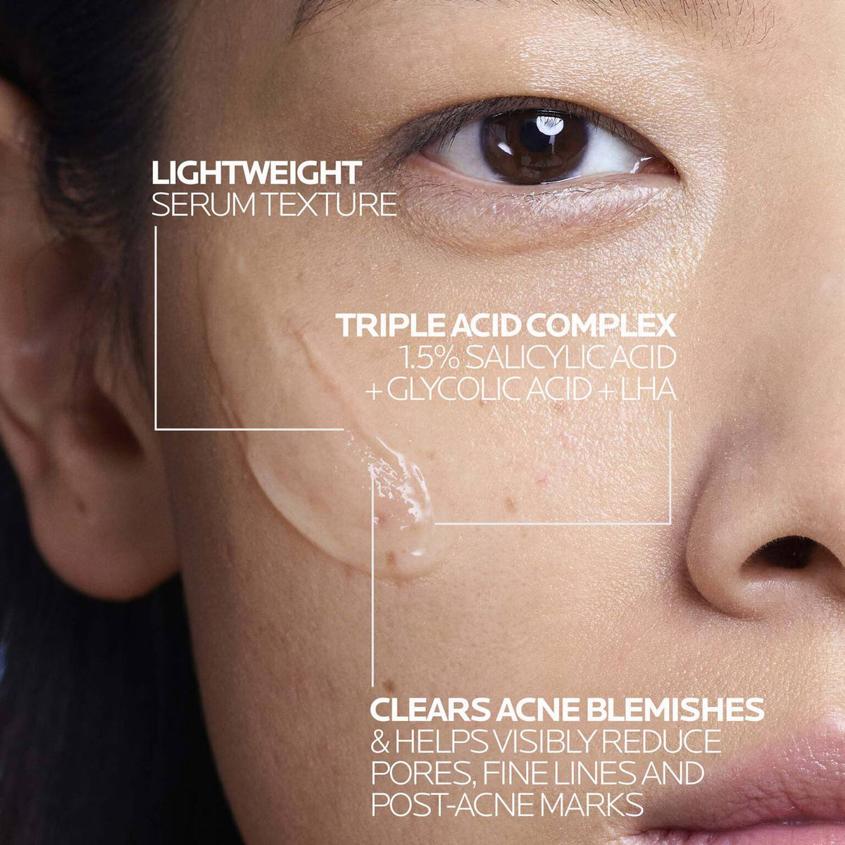 effaclar-salicylic-acid-acne-treatment-serum-l7 LaRochePosay-Product-Effaclar-Effaclar-Serum-30ml-3337875722827-Texture-REV.jpg LaRochePosay-Product-Effaclar-Effaclar-Serum-30ml-3337875722827-Texture-REV_243050550f1c.jpg