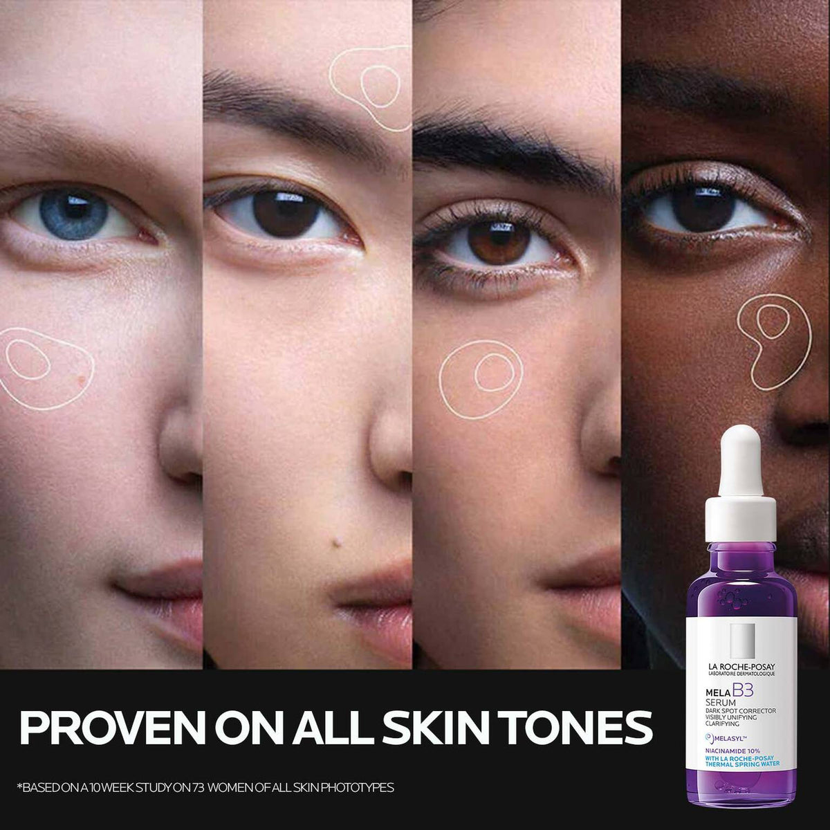 mela-b3-dark-spot-serum-with-melasyltm-niacinamide-x2 Mela-B3-SuitableFor-1500x1500.jpg Mela-B3-SuitableFor-1500x1500_a2d4a8a37f86.jpg