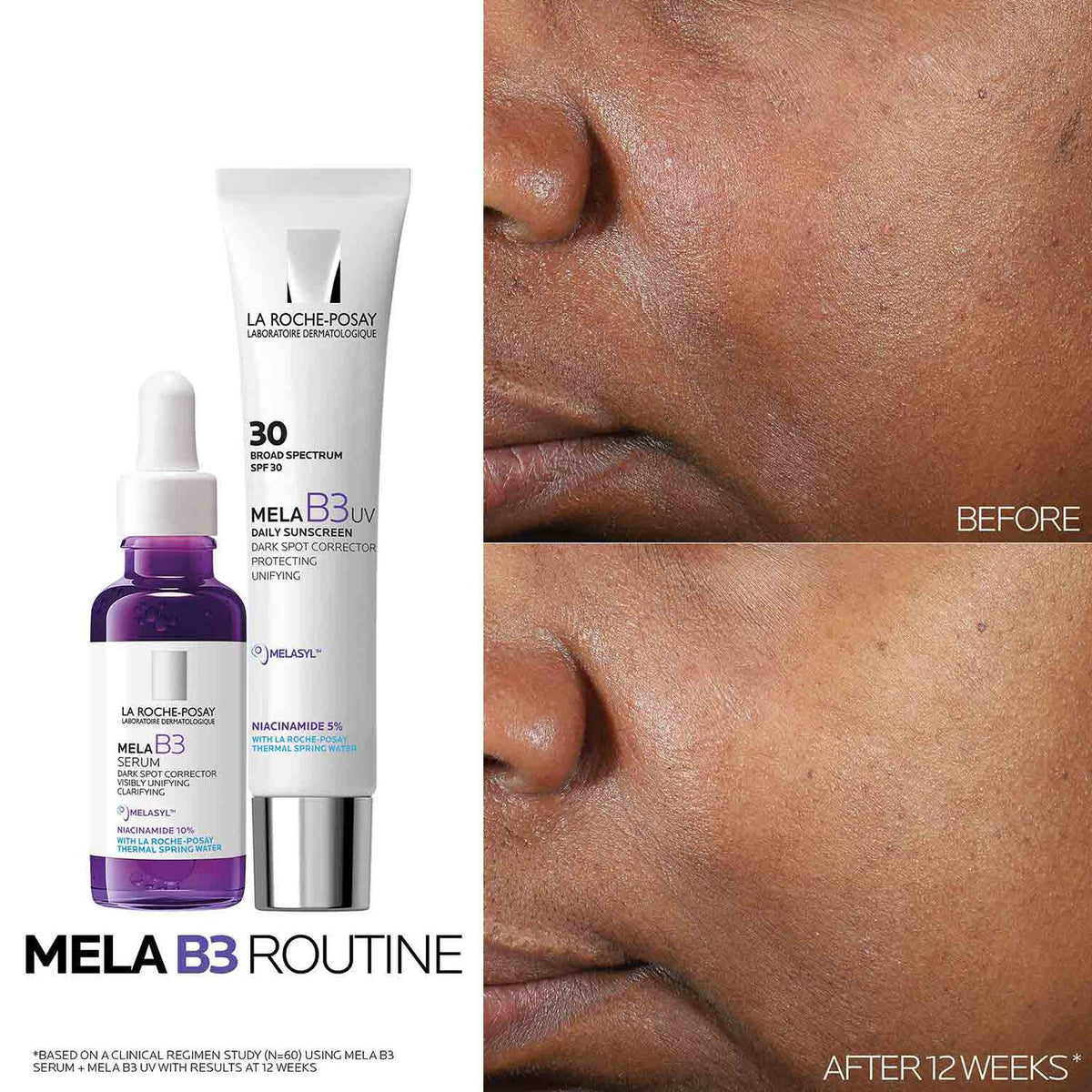 mela-b3-dark-spot-serum-with-melasyltm-niacinamide-x2 Mela-B3-routine_1500X1500.jpg Mela-B3-routine_1500X1500_4218e8d2a51a.jpg