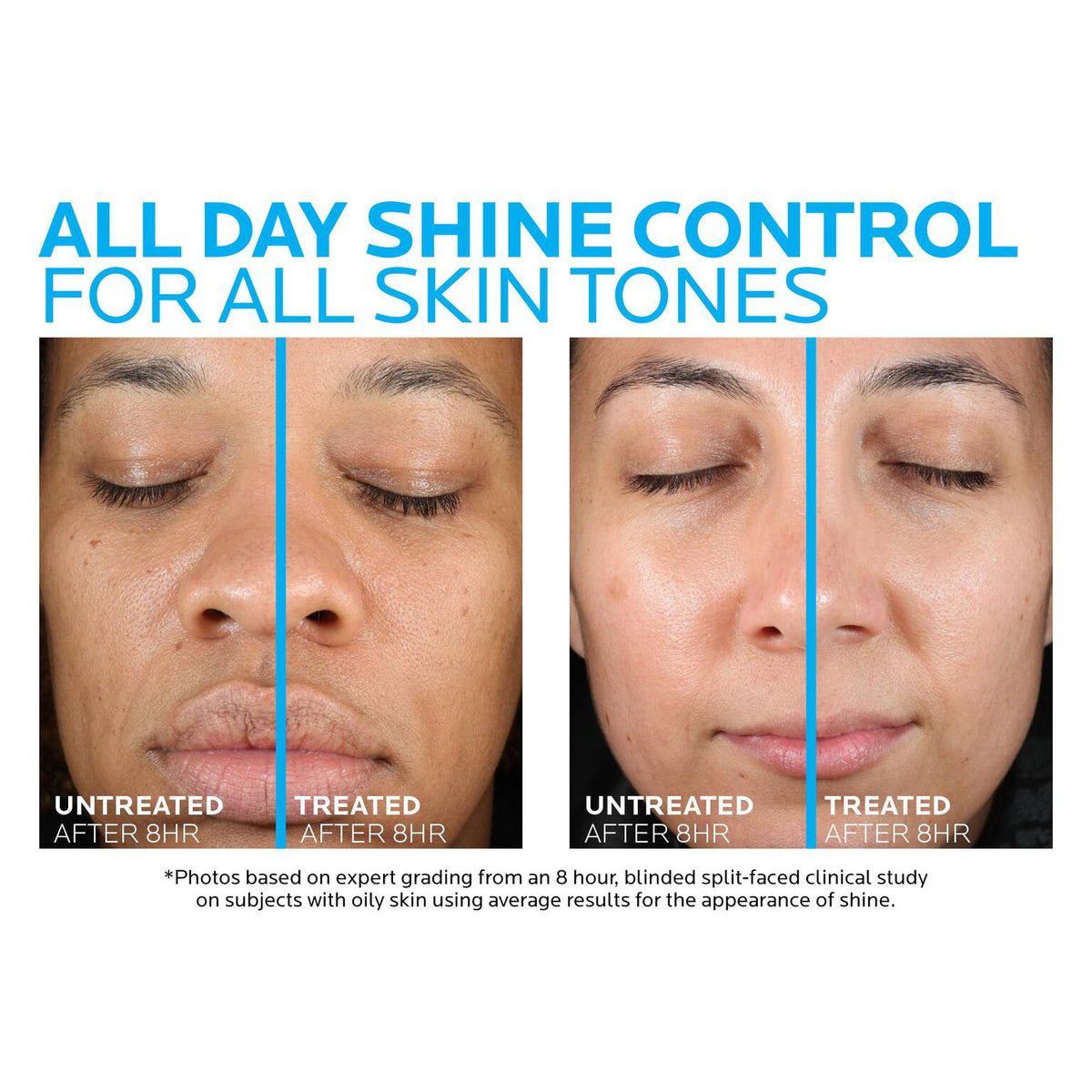 toleriane-double-repair-matte-face-moisturizer-for-oily-skin-t1 la-roche-posay-toleriane-matte-moisturizer-before-and-after-pdp-alt.jpg la-roche-posay-toleriane-matte-moisturizer-before-and-after-pdp-alt_29894fb3234d.jpg
